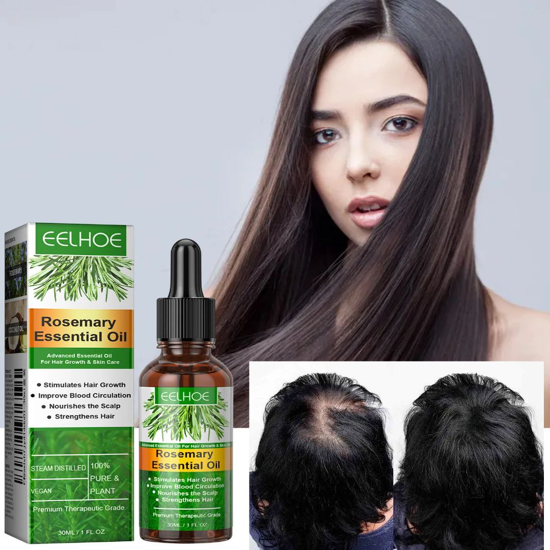 Aceite esencial de romero eelhoe para el crecimiento del cabello AMC-2531
