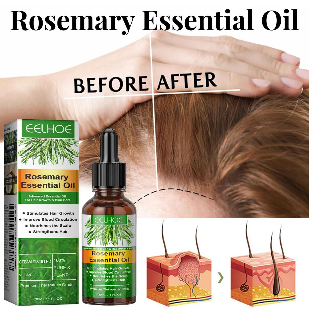 Aceite esencial de romero eelhoe para el crecimiento del cabello AMC-2531