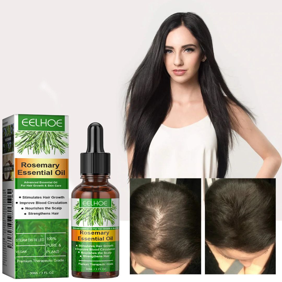 Aceite esencial de romero eelhoe para el crecimiento del cabello AMC-2531